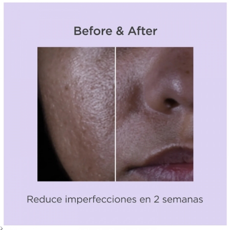 ISDINCEUTICS SALICYLIC RENEWAL SERUM 30ML