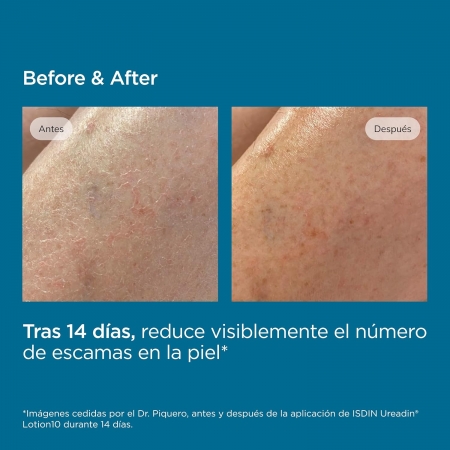 UREADIN LOTION 10 HIDRATACION INTENSA 400 ML CON DOSIFICADOR