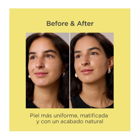 ACNIBEN CC CREAM MEDIUM 40ML