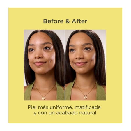 ACNIBEN CC+CREAM BRONZE 40ML