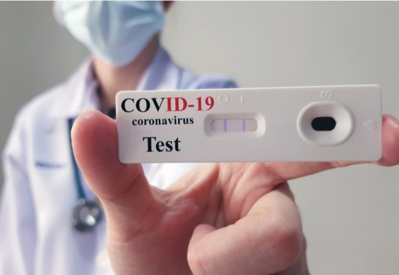 Test para detectar COVID-19